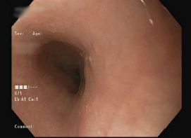 Figure 1a