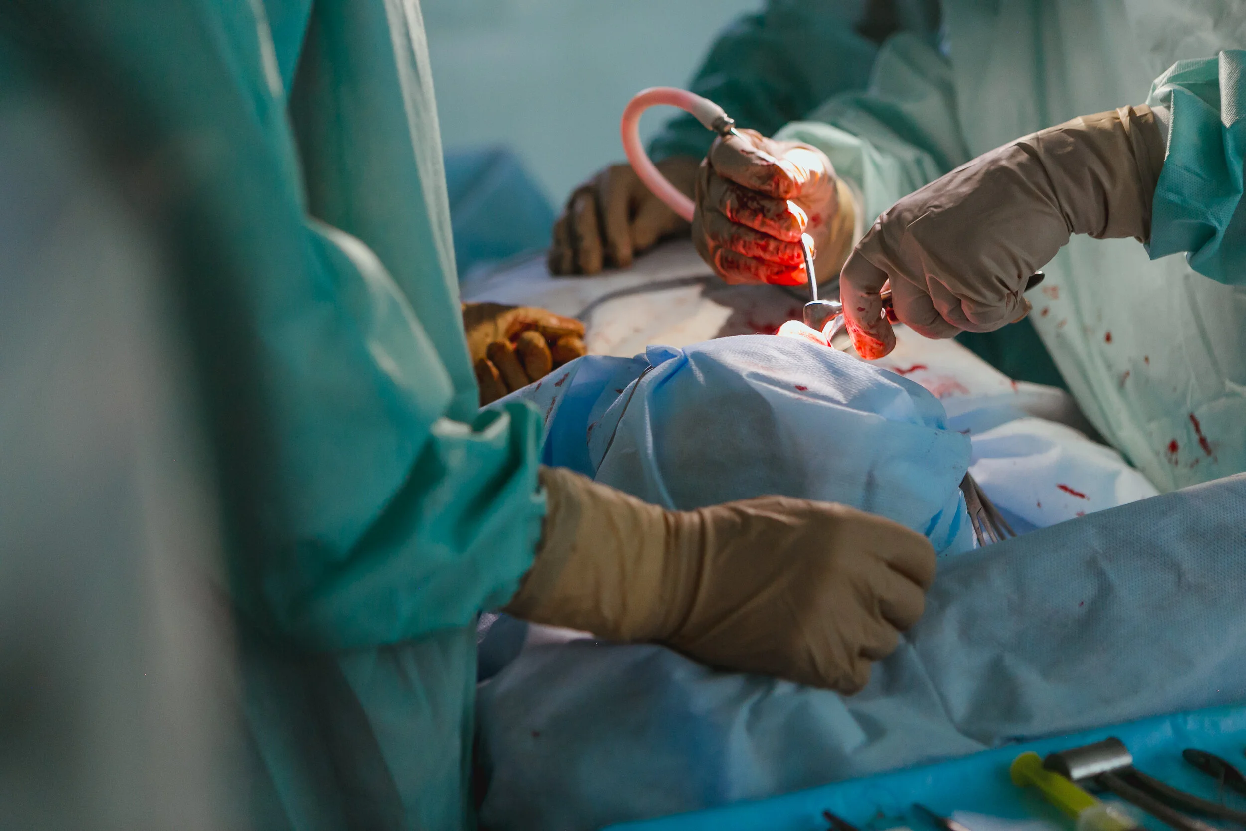 Rare, But Can’t Miss: Necrotizing Fasciitis in the Pediatric Population