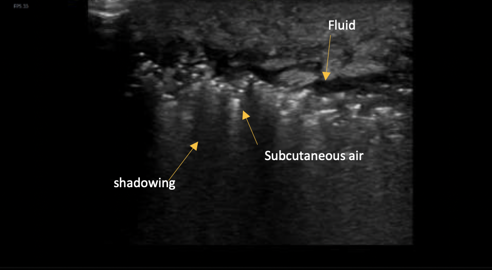 Figure 1. Scrotal Ultrasound