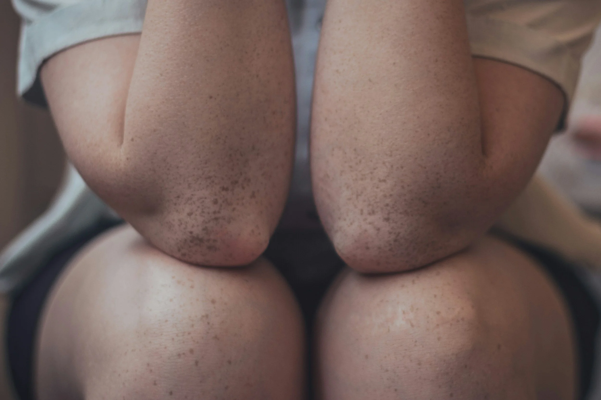 FAST TRACK: Nursemaid’s Elbow
