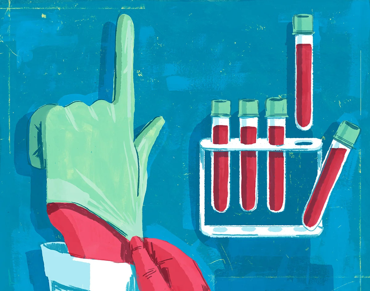 New Prostate Cancer Blood Test
