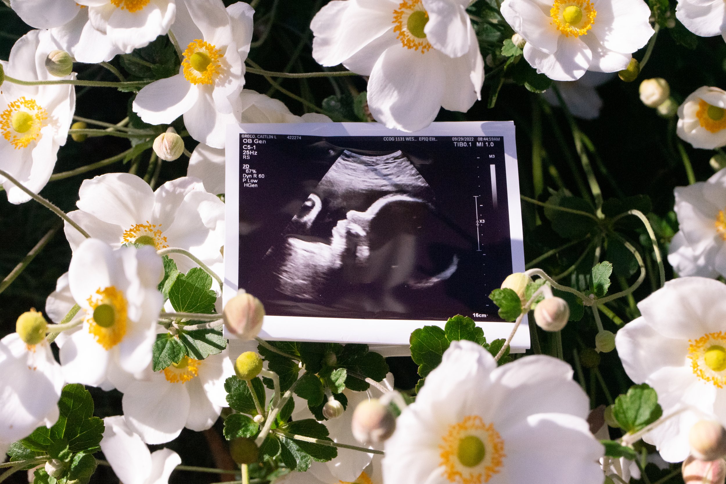GrecoMaternity-77.jpg