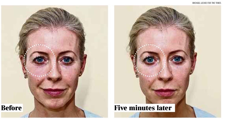 The before and after pictures from The Times, by Michael Leckie