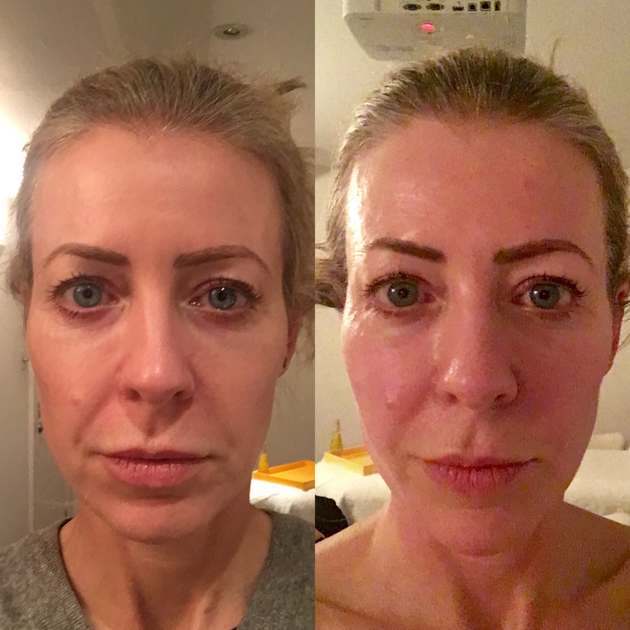 Before - left - and after a session of Decleor's new 'facial pilates' face massage 