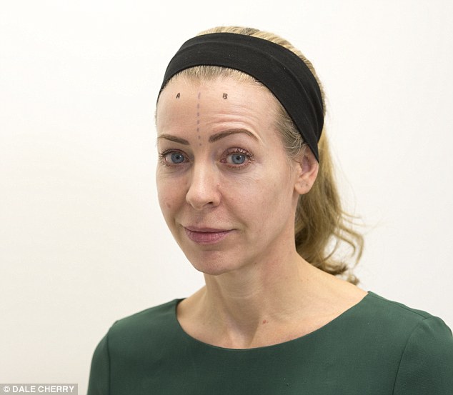 Side A - Botox - I can't move my eyebrows at all! Side B - 'Botox-effect' products have zero effect, and I can lift my brow as normal. 
