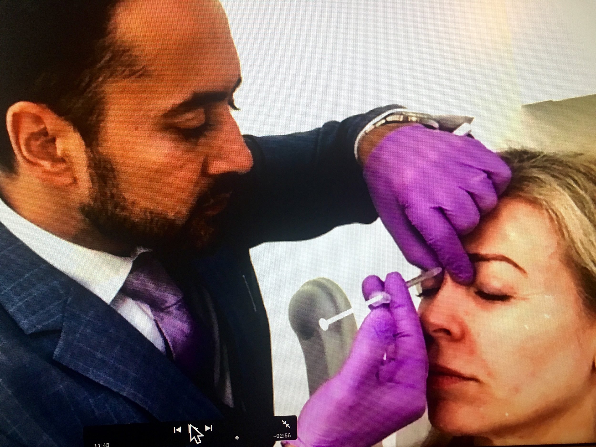 Having Botox shots between the eyebrows with Dr Tapan Patel