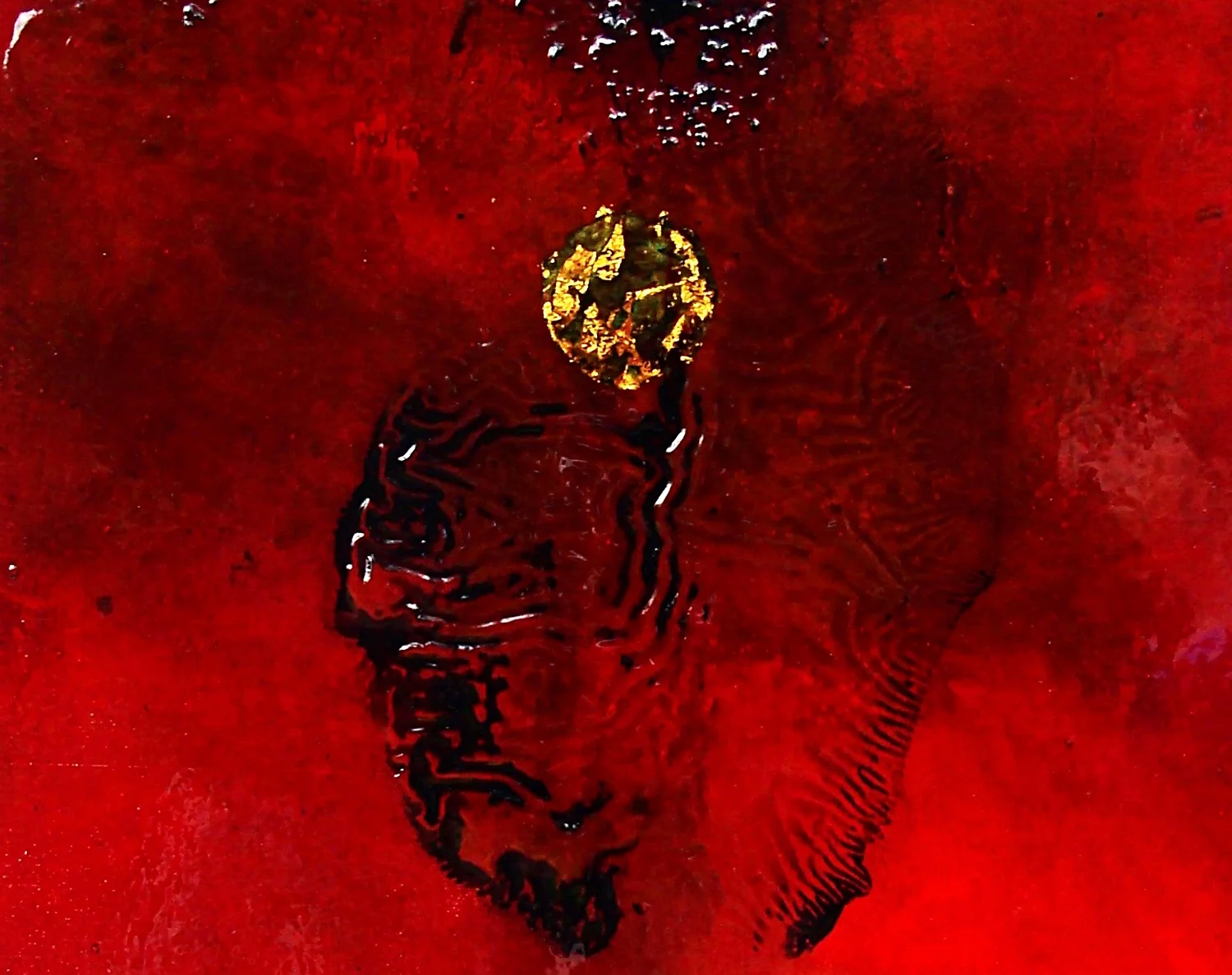 Haematoma 2