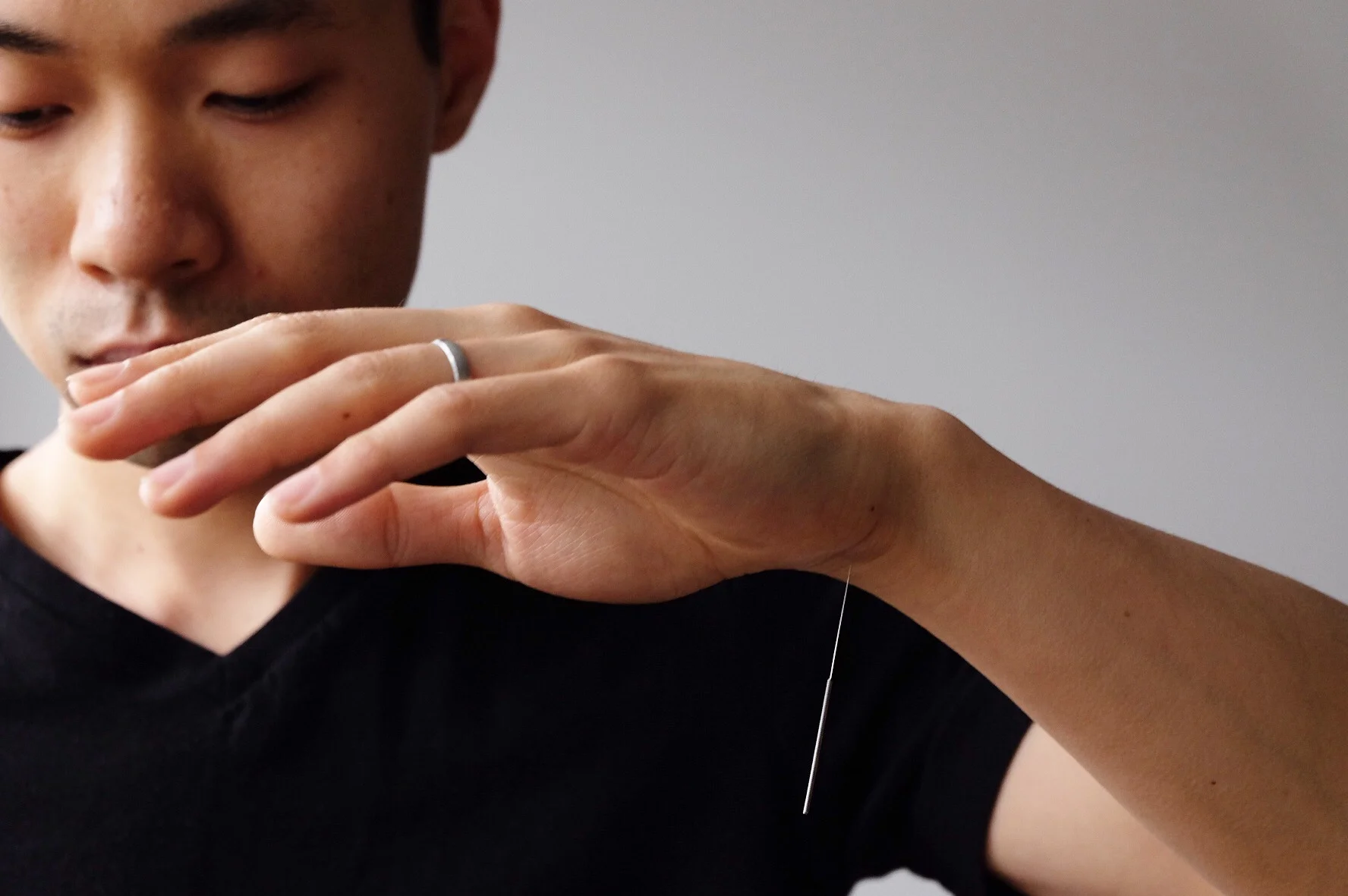 Acupuncture: A Lifestyle