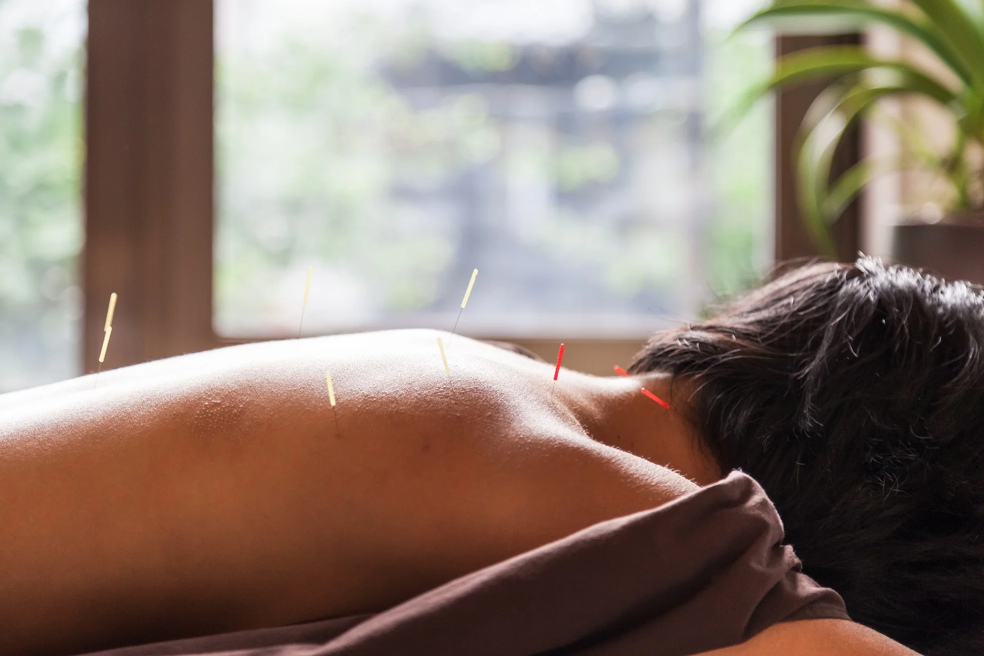 FAQ Acupuncture Toronto.jpg