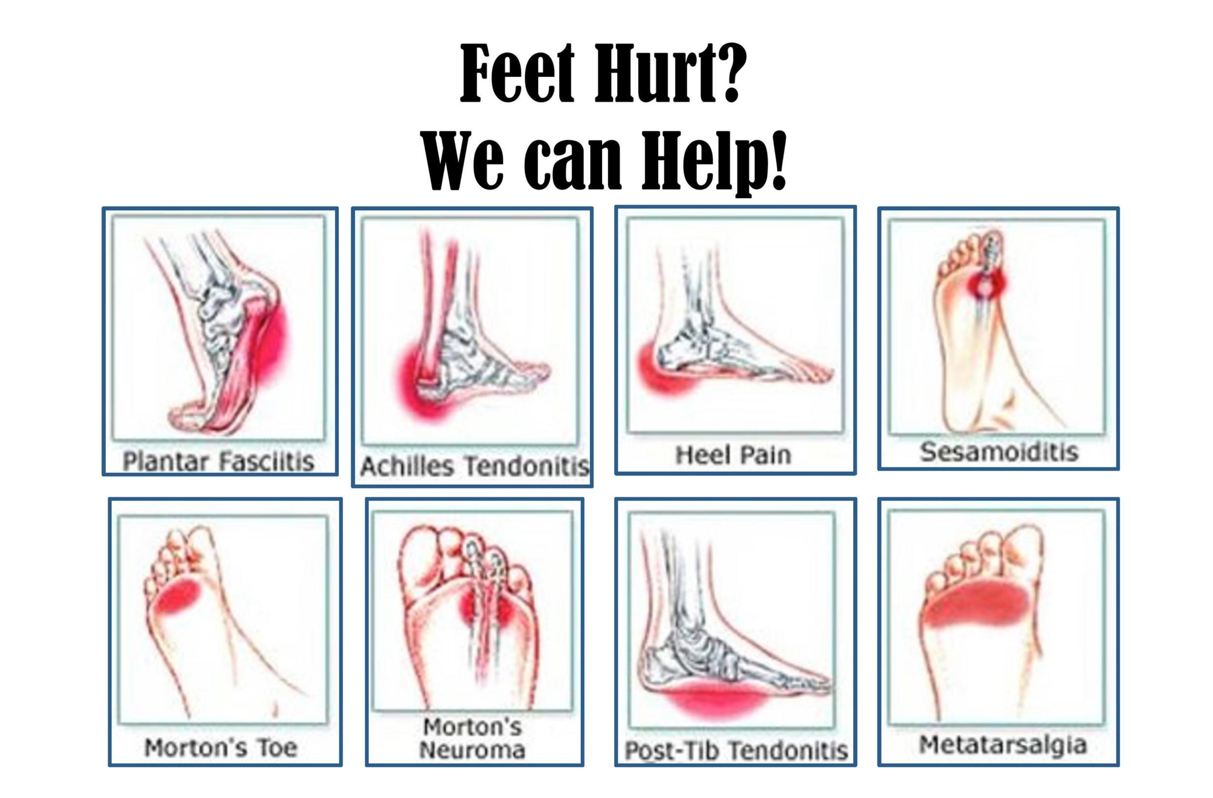 Common Areas of Foot Pain-page-001.jpg