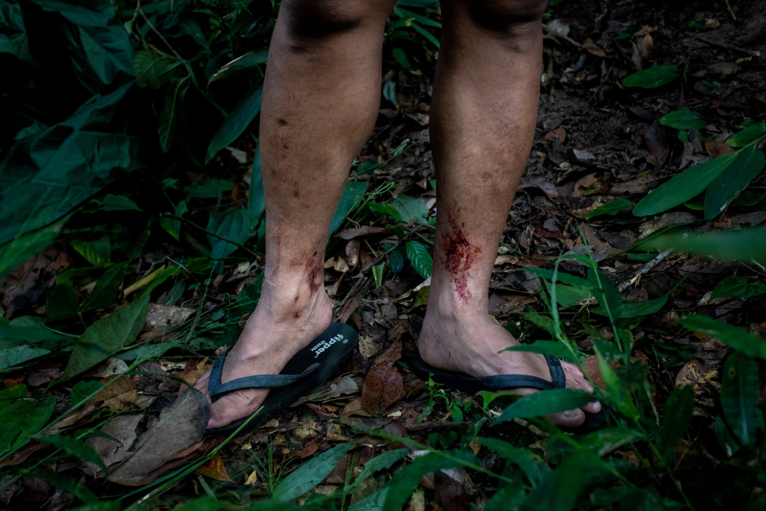  A Wildlife Alliance ranger shows off his still bleeding leech bites after a long day spent dismantling snares in the Cardamom Forest. 