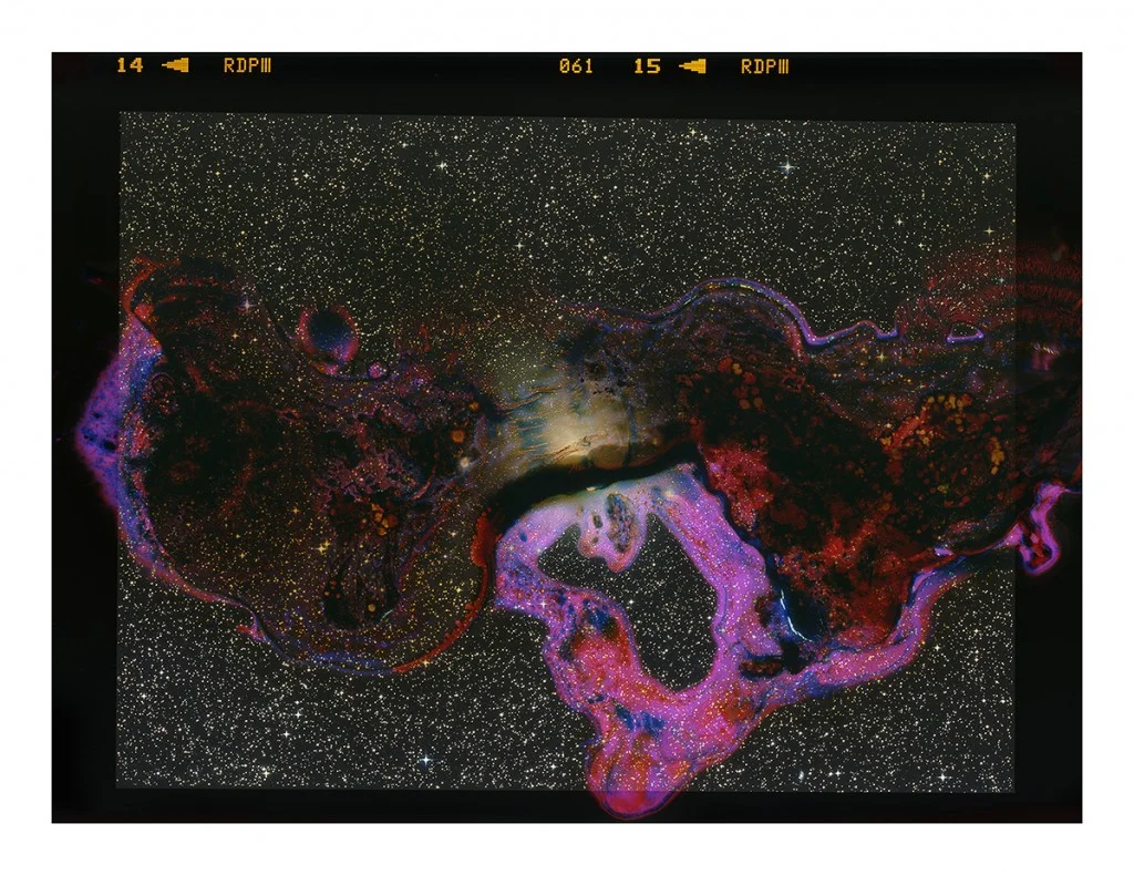 A Photograph of the Little Dumbbell Nebula Eaten by Bacteria Found on My Gym’s 20-Pound Dumbbells