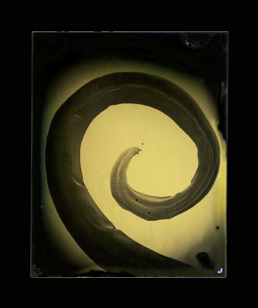 Ascaris lumbricoides