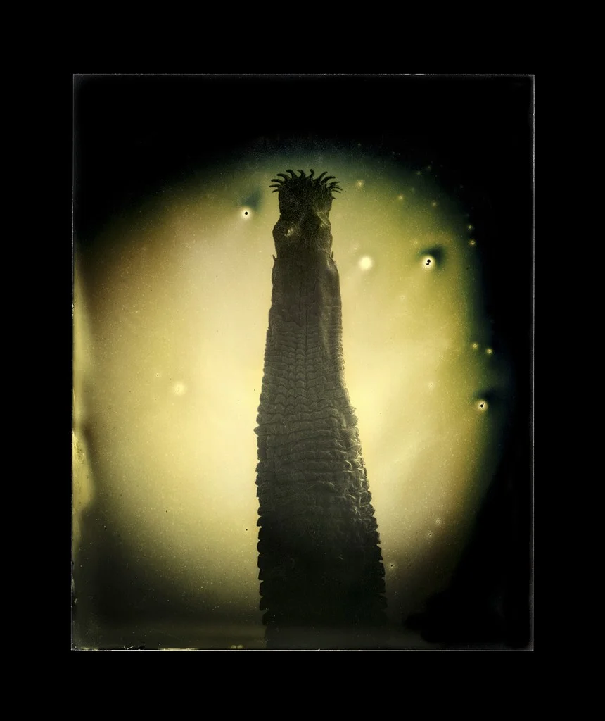 Taenia solium