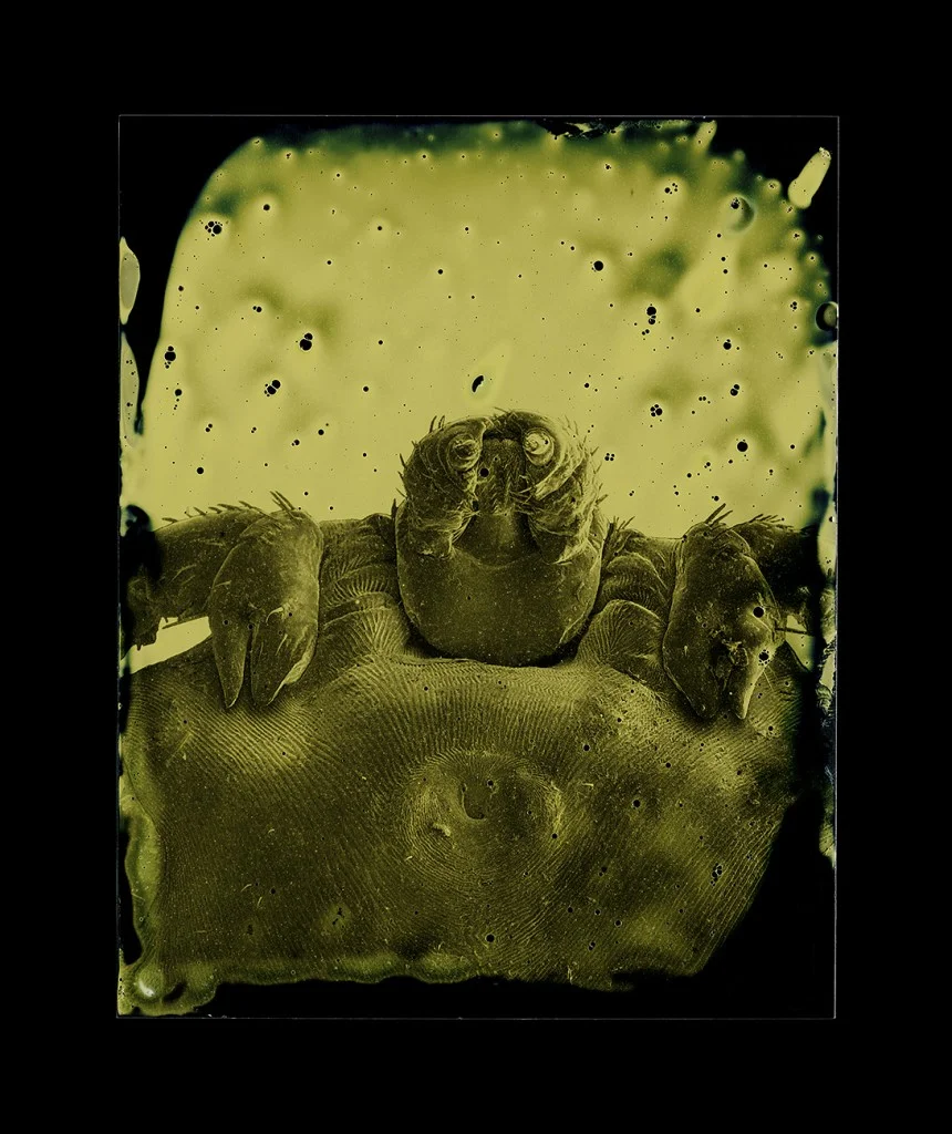 Dermacentor andersoni