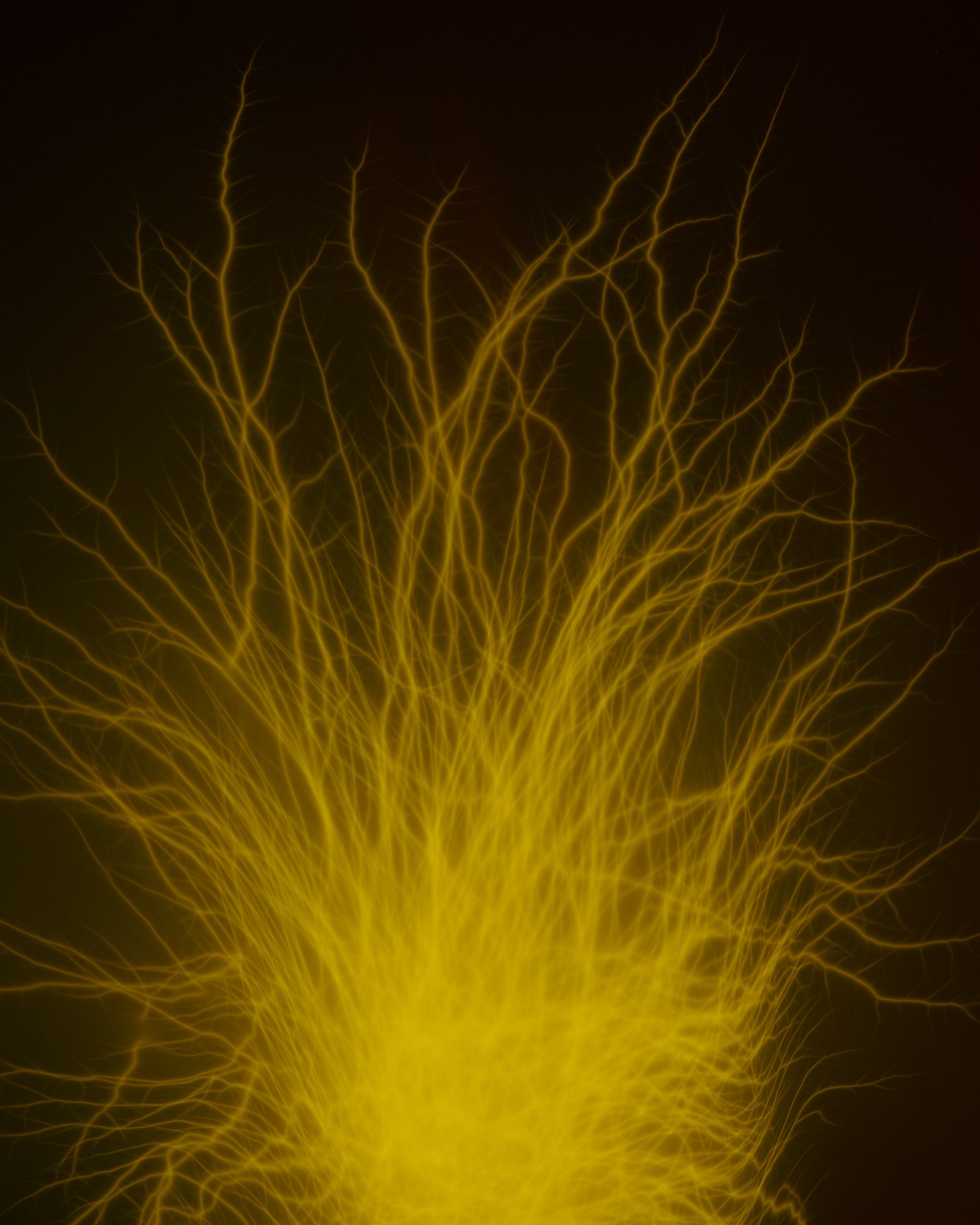 Shocked Directly On His Genitals