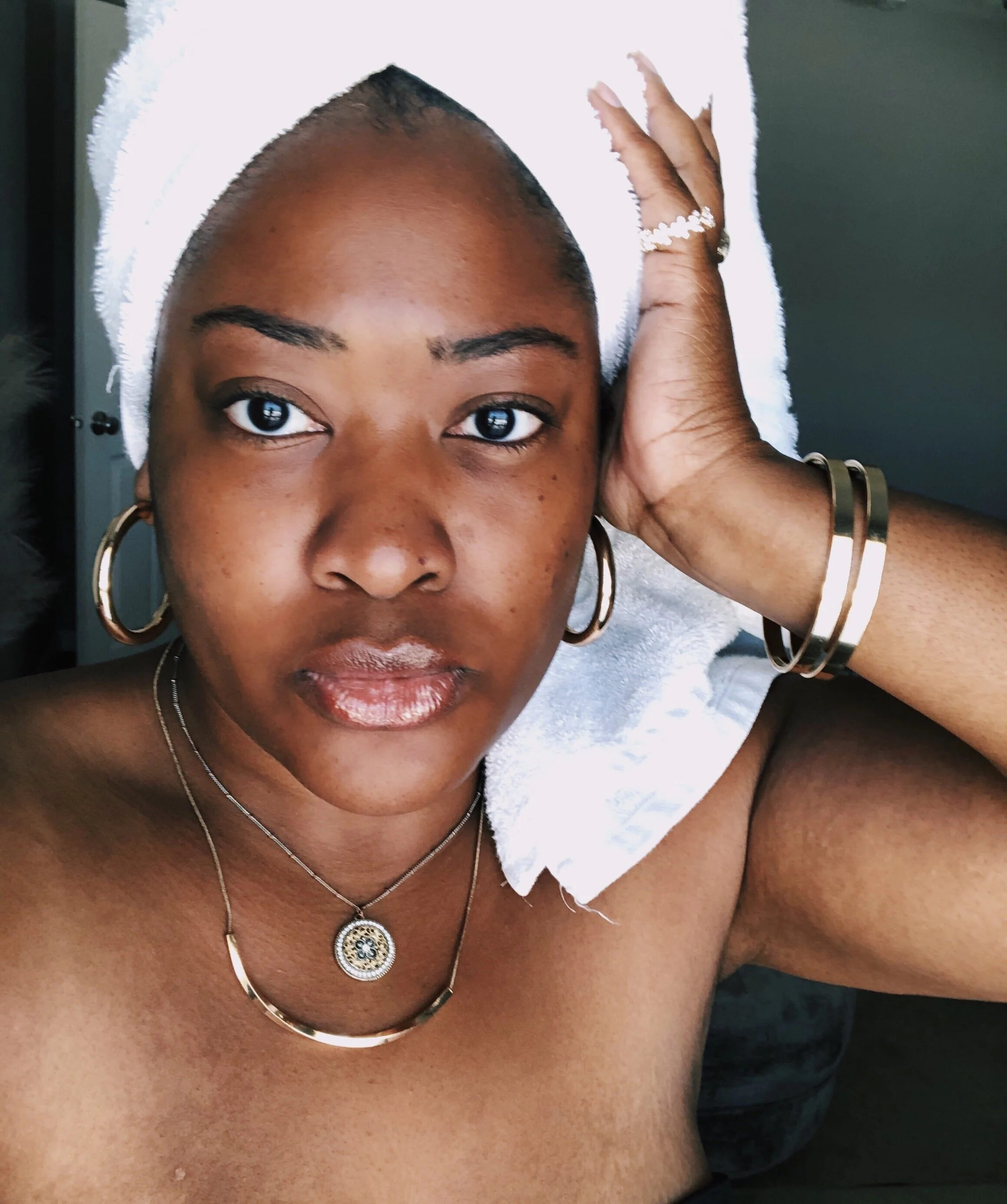 Fighting Hyperpigmentation: My Skin Care Routine