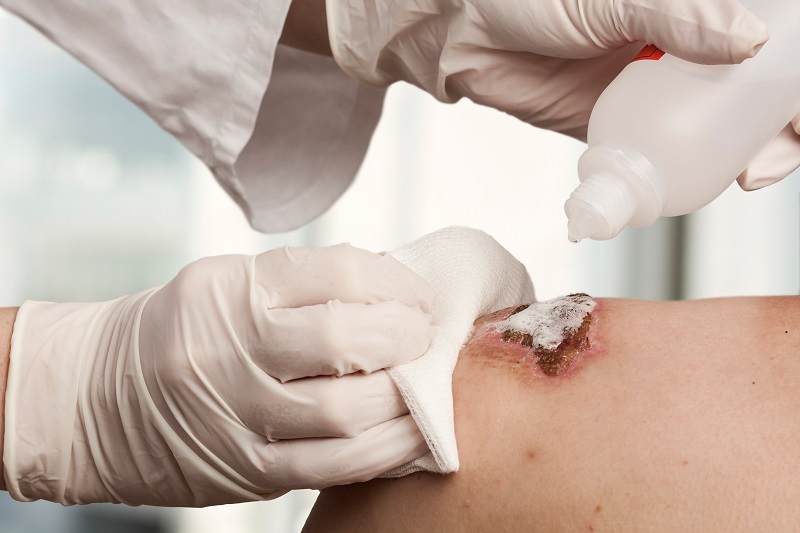 Wound-Care-Pic.jpg