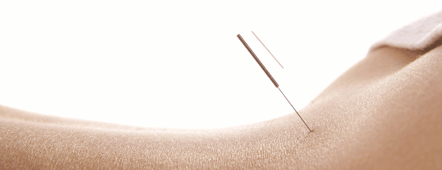 Slider2_needle.gif