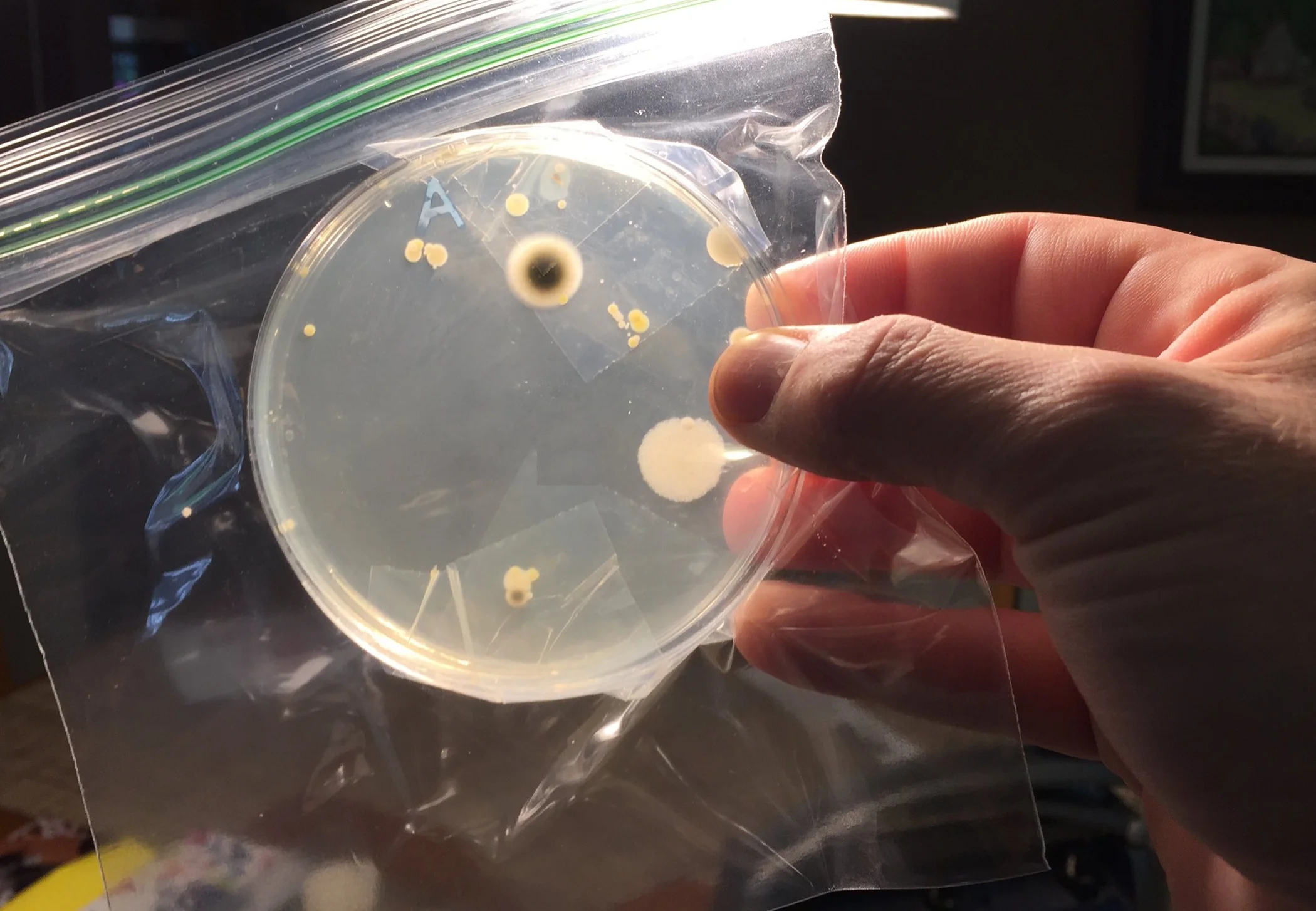 Why Don't Antibiotics Work Like They Used To?