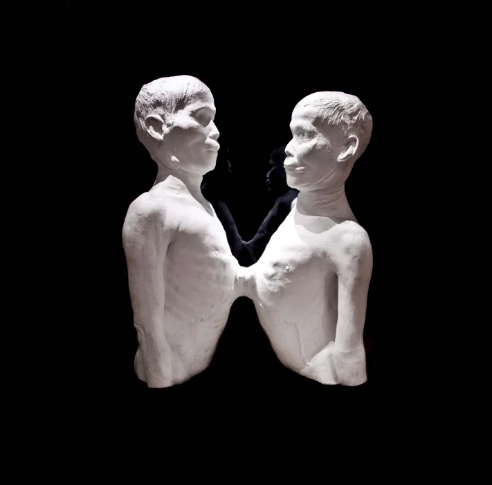 Image via The Mütter Museum