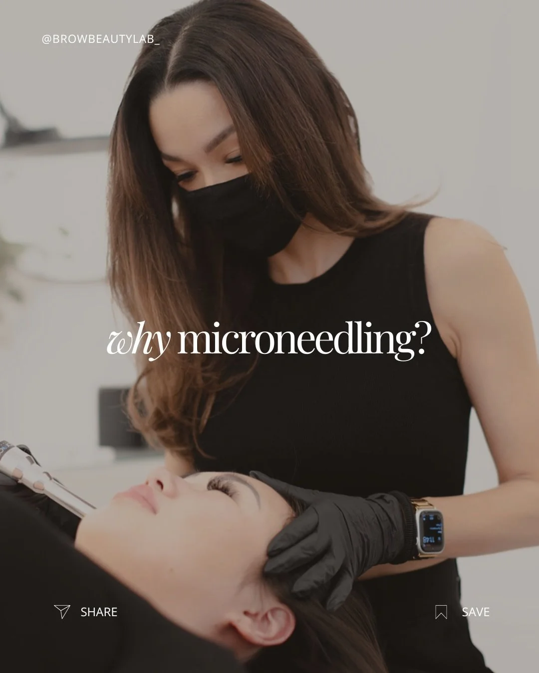 If you&rsquo;ve tried everything and your skin still feels &ldquo;meh&rdquo; - read this 👇

Microneedling works below the surface, helping your skin rebuild collagen so texture, tone, and overall quality improve over time.

It&rsquo;s not about chan