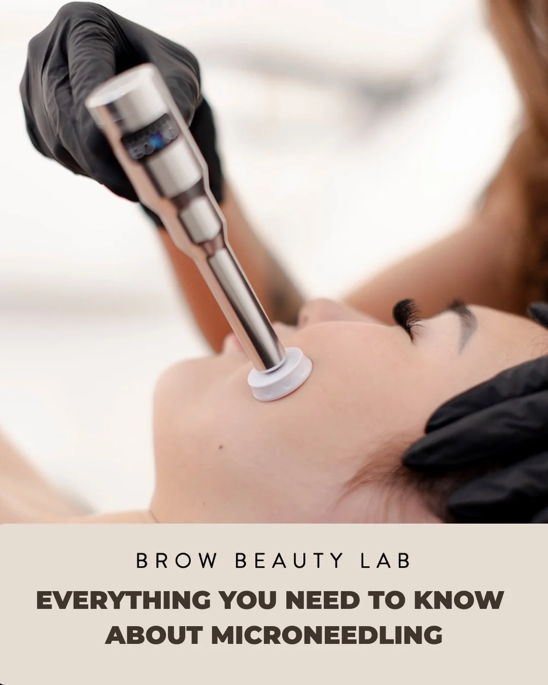 Nobody talks about how much is actually happening beneath your skin during microneedling.

Not the surface stuff.
The real stuff.

Here&rsquo;s everything you actually need to know &mdash; slide by slide. 👇

We&rsquo;re talking controlled micro-inju