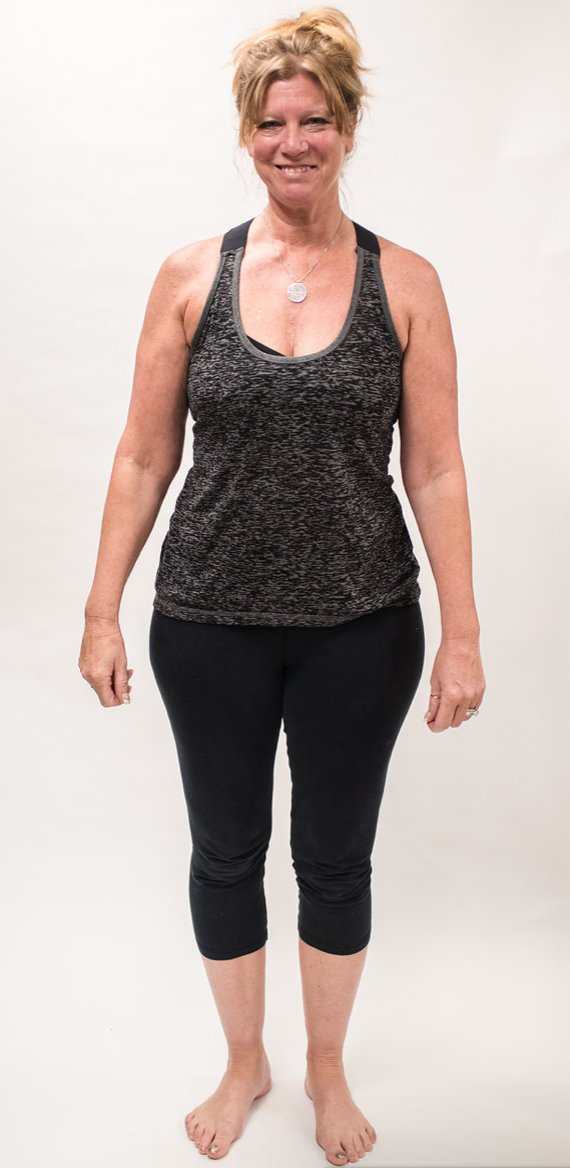 Before - Gail N.