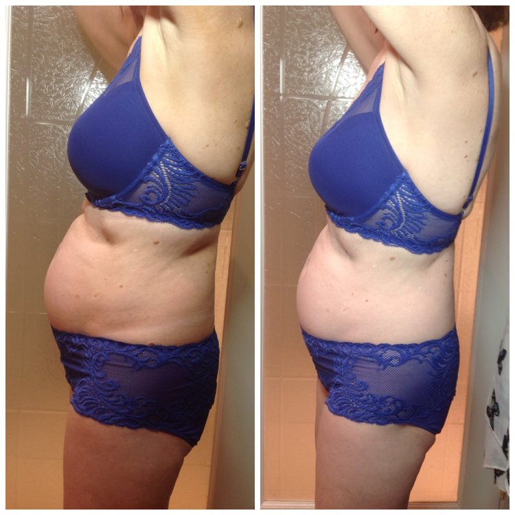  Combination of 6 LPG Integral Treatments and 6 Inch-Loss Body Wraps!   