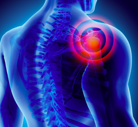 FREE CEU: Sports Medicine Exam of the Shoulder