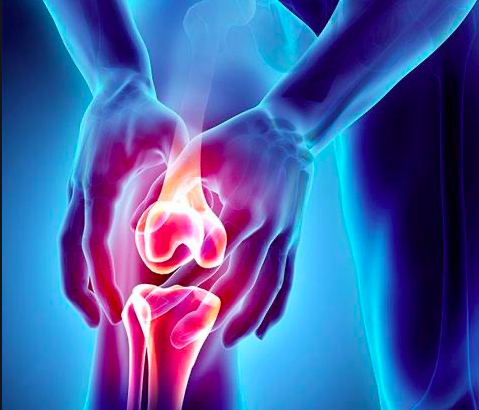 Free CEU: Sports Medicine Exam of the Knee
