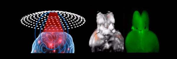 Functional Neuroimaging and Large-Scale Brain Recording