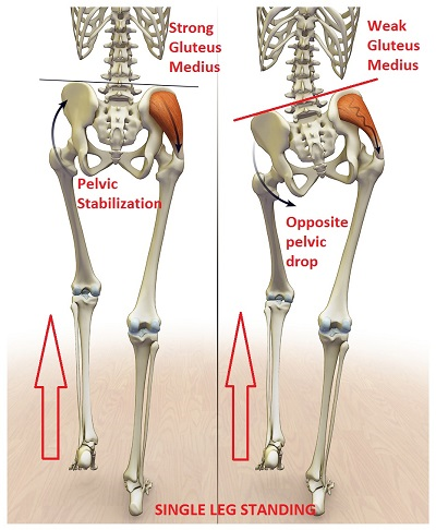 weak glute med.jpg