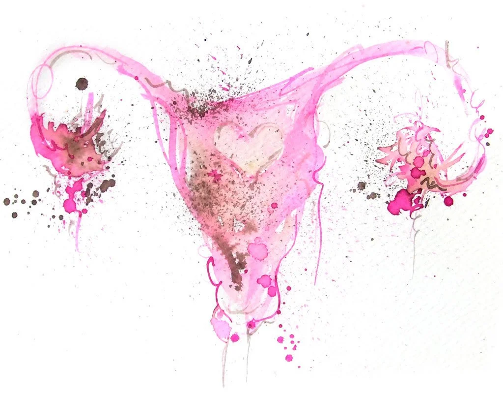 endometriosis.jpg