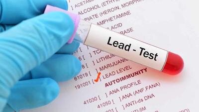 Lead testing
