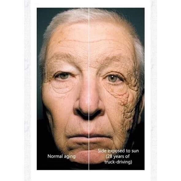 &quot;I don't need sunscreen&quot;
&quot;I don't like the way it makes my skin feel&quot;
&quot;My makeup already has SPF&quot;

blah!

blah!!

blah!!!

Go look at yourself in the mirror and tell me if your face looks symmetrical. Why do you think th