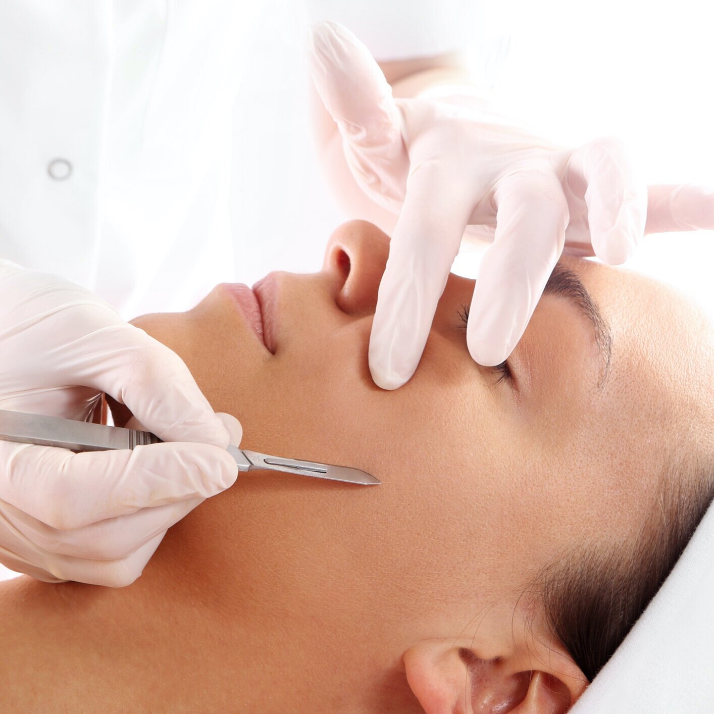 Dermaplaning