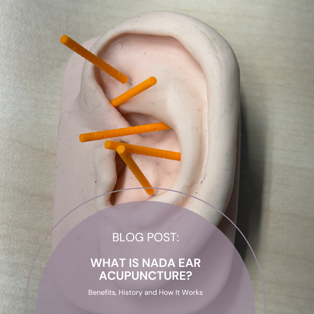 What Is NADA Ear Acupuncture? Benefits, History and How It Works