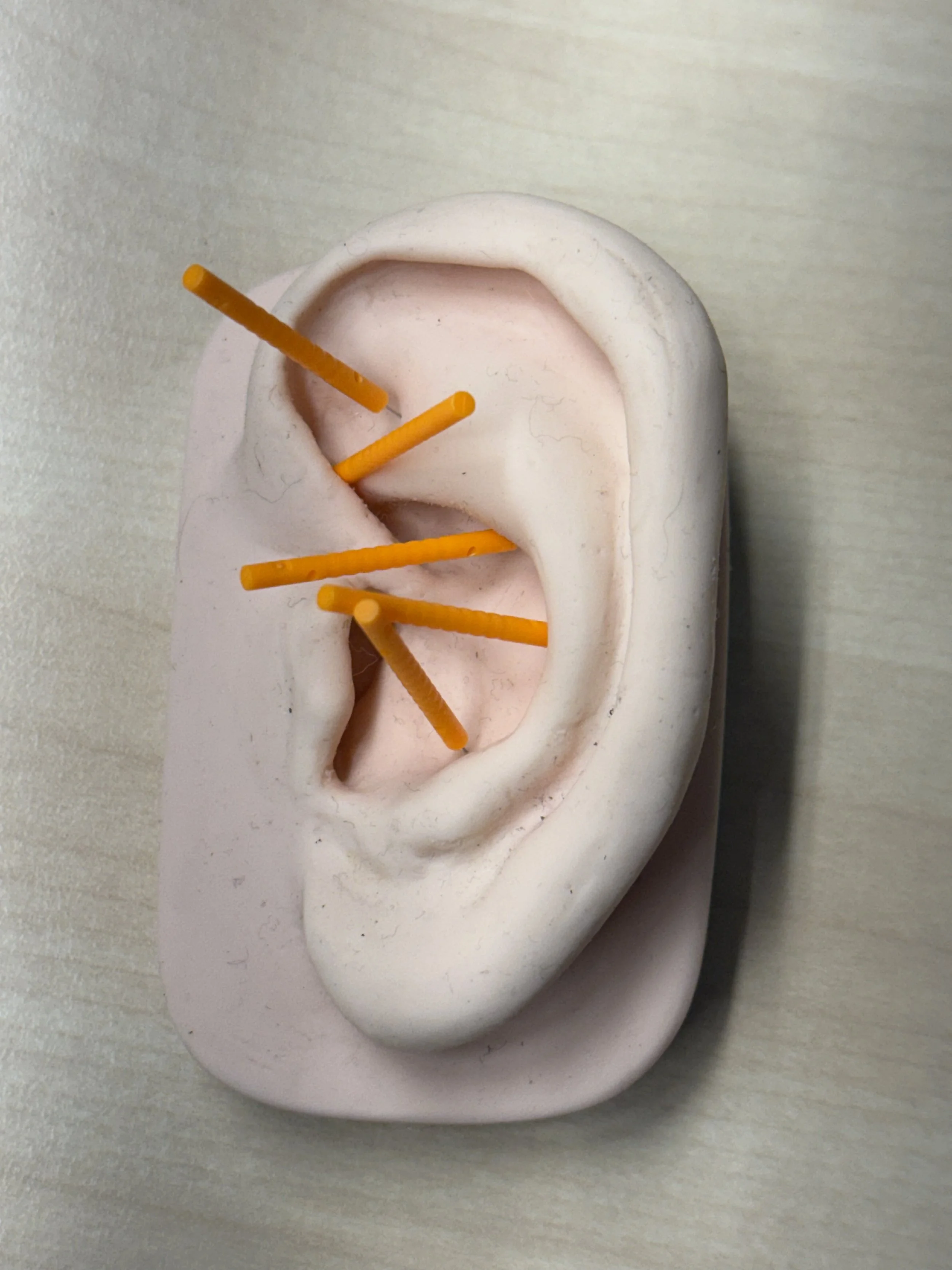 model ear with acupuncture needles in it