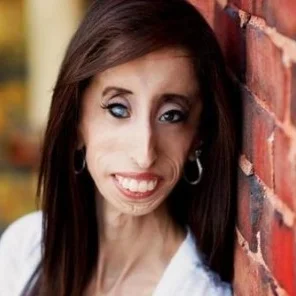 LIZZIE VELASQUEZ