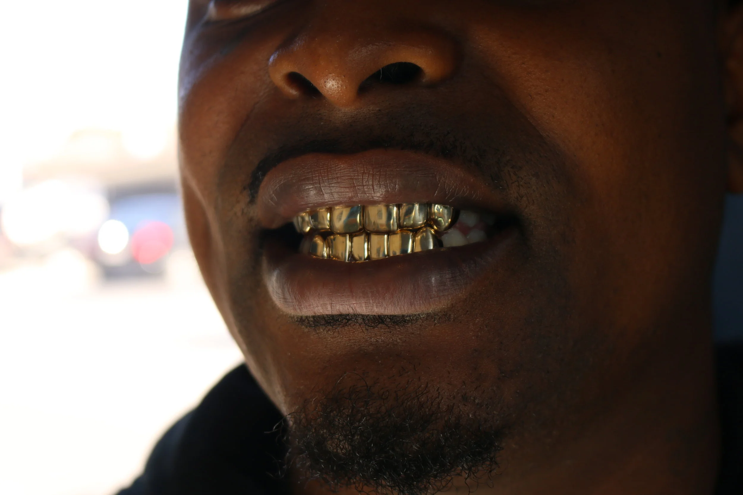 Close-up of a person's mouth showing gold grills on their teeth.