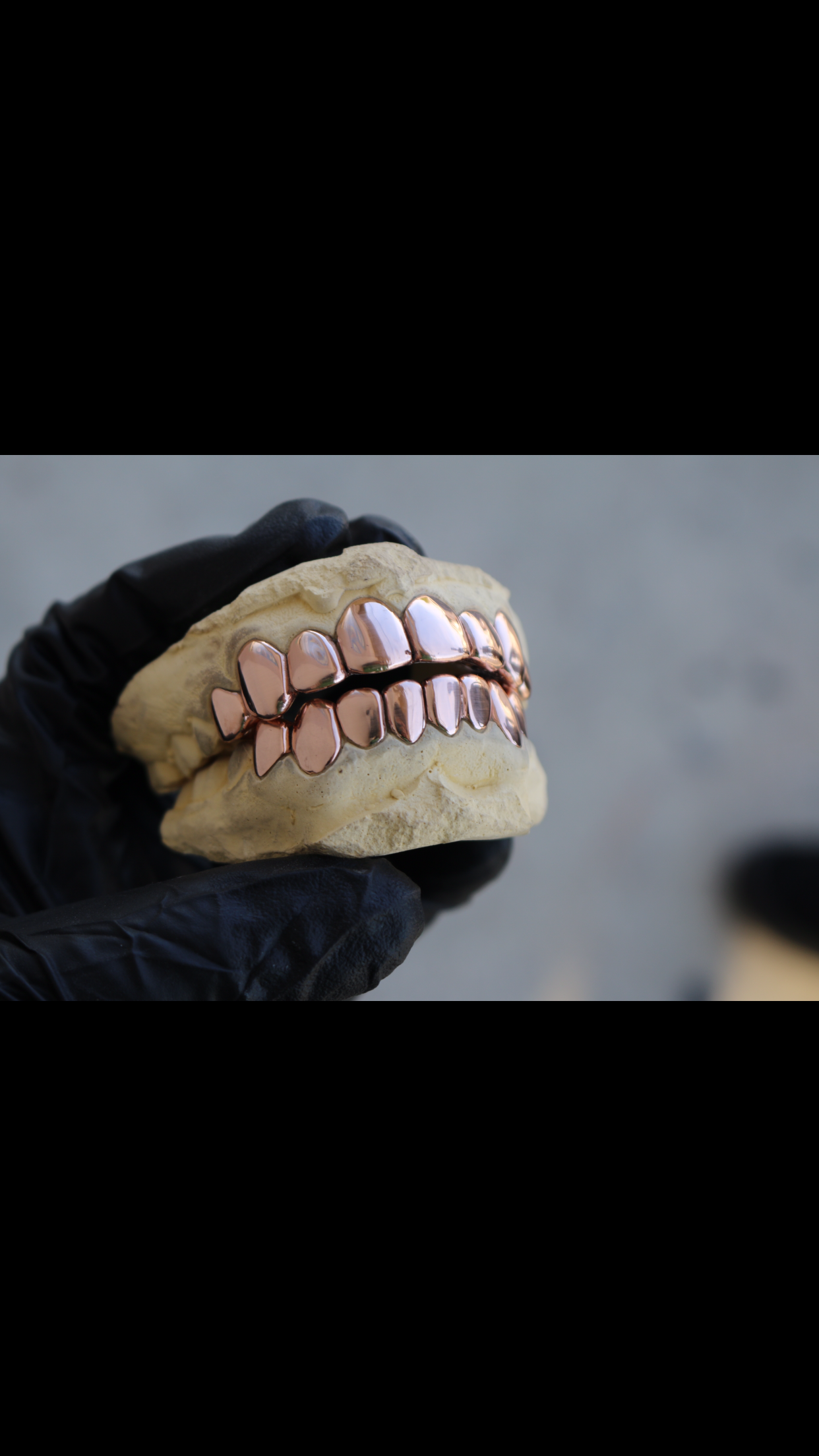A person wearing black gloves holding a dental mold with shiny, metallic, rose gold teeth.