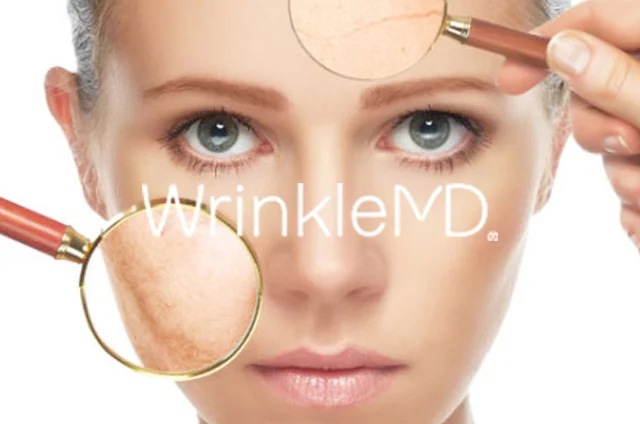 13.-Wrinkle-MD.jpg