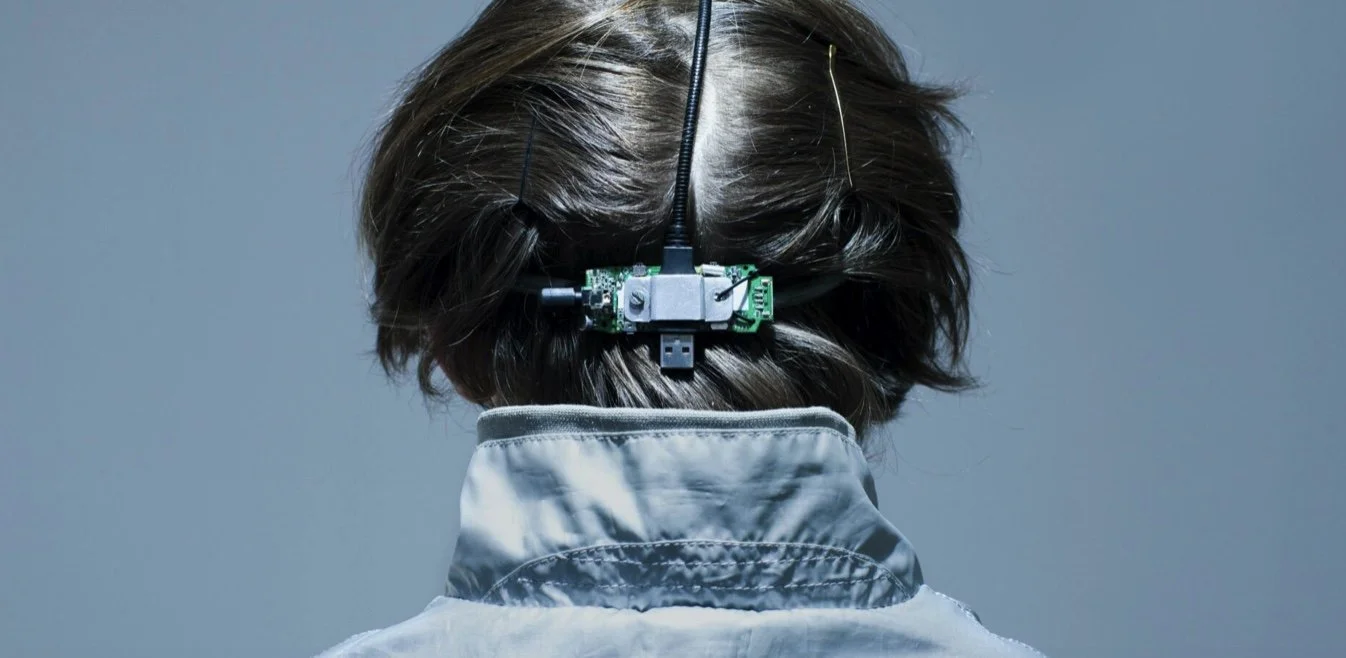 Neil Harbisson back of head.jpg