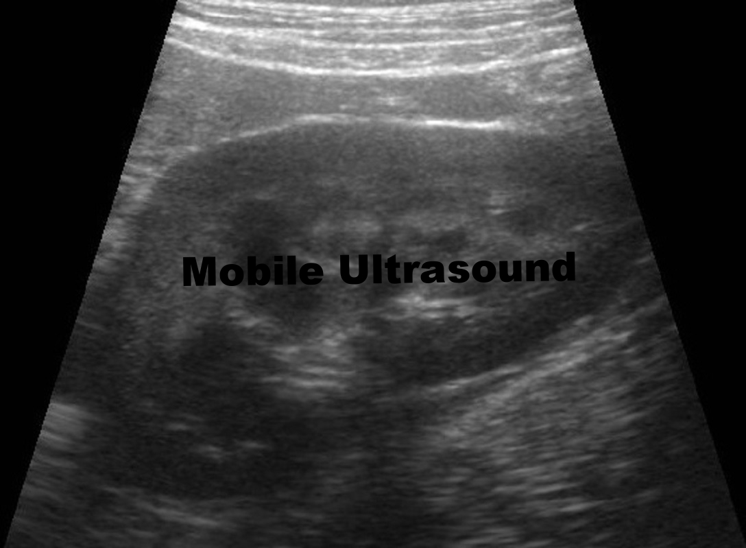 Mobile Ultrasound