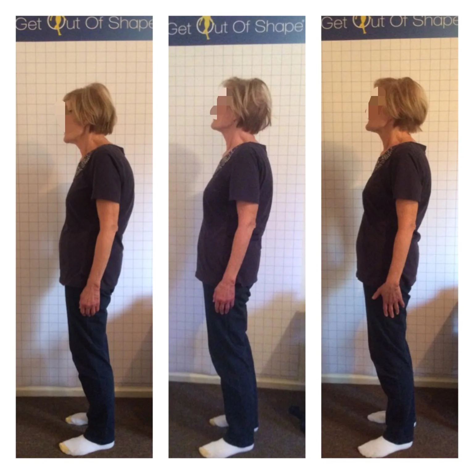 "My humped back was straight again!"