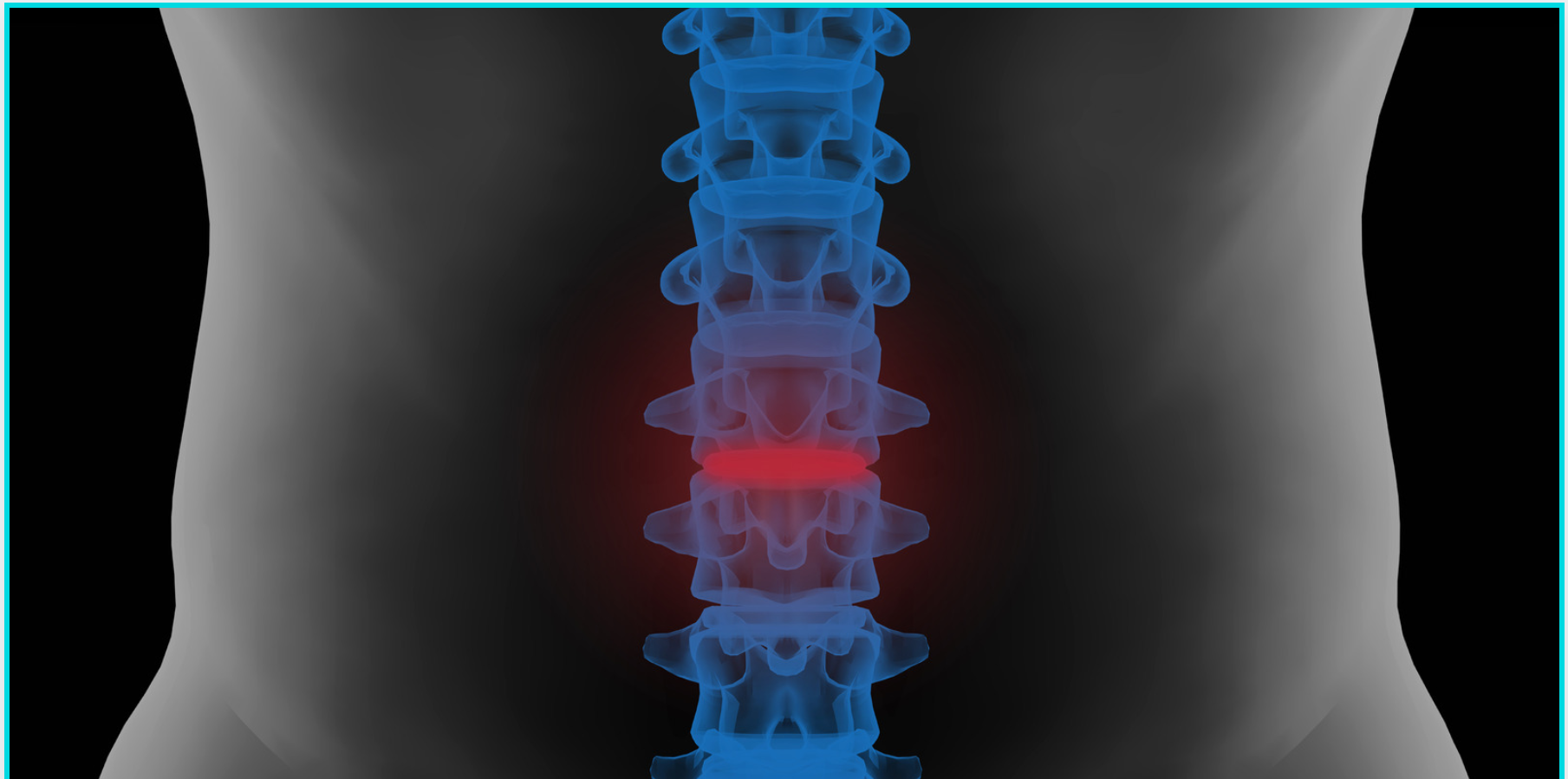 Lumbar Facet Pain and Nerve Blocks
