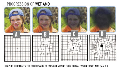 curing vision with healthy lifestyle.jpg