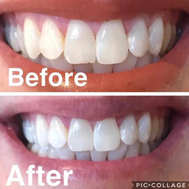 teeth 2.jpg