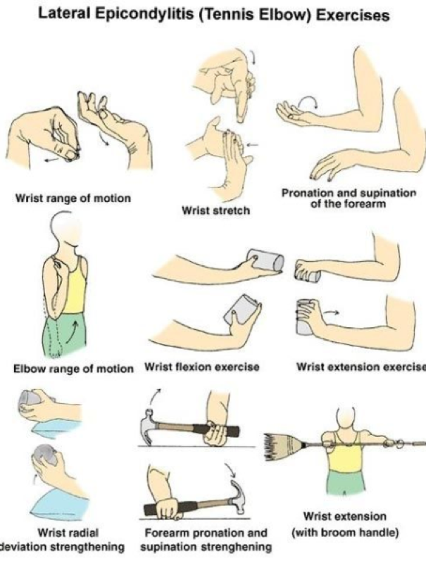 Lateral Epicondylitis Exercises
